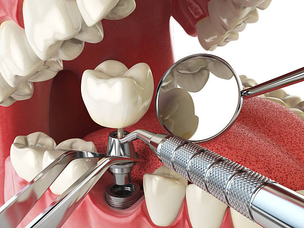 Best Emergency Treatment for Toothache in Anchorage, AK